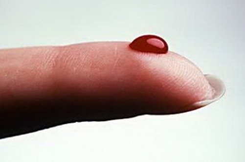 Почему густая кровь это плохо — Полезная информация